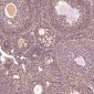 Anti-Glutamine Synthetase GLUL Rabbit Monoclonal Antibody